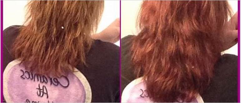Before after biotin
